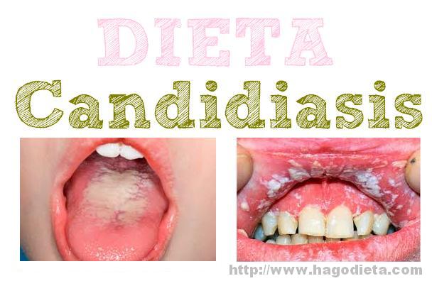 dieta-candidiasis-http-www-hagodieta-com